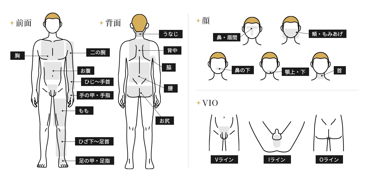 男性用医療脱毛 脱毛可能部位