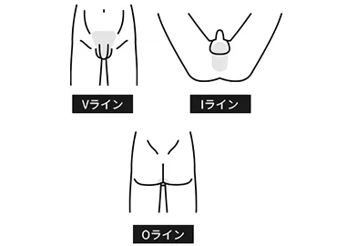 VIO都度払い14,020円(税込)
