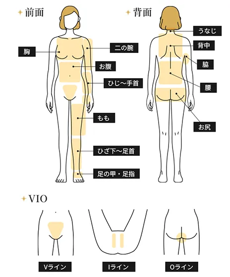全身＋VIO（うなじ・指先含む）都度払い37,070円(税込)