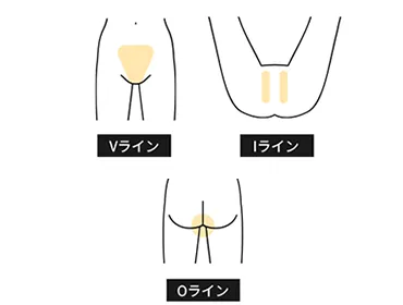 VIO都度払い10,780円(税込)