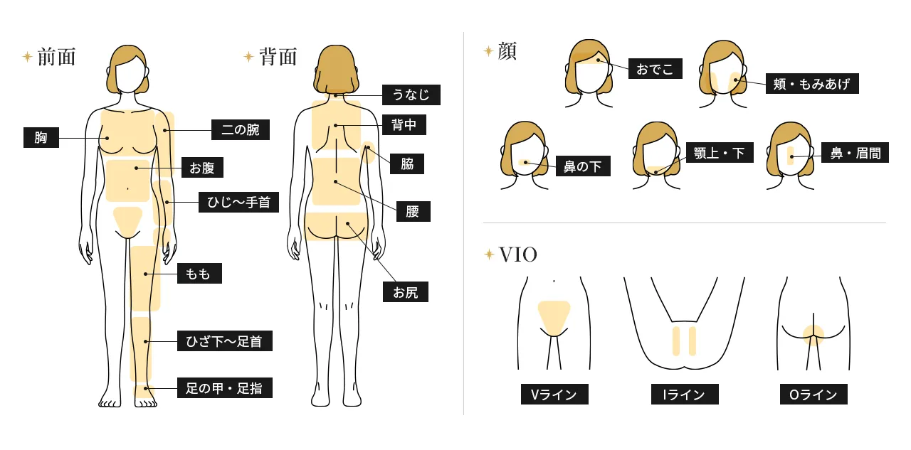 女性用医療脱毛 脱毛可能部位SP